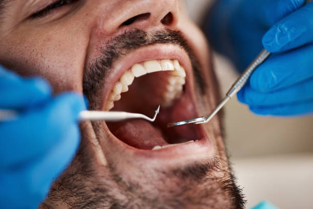 Best Emergency Dental Care for Broken or Chipped Teeth in Presque Isle, ME